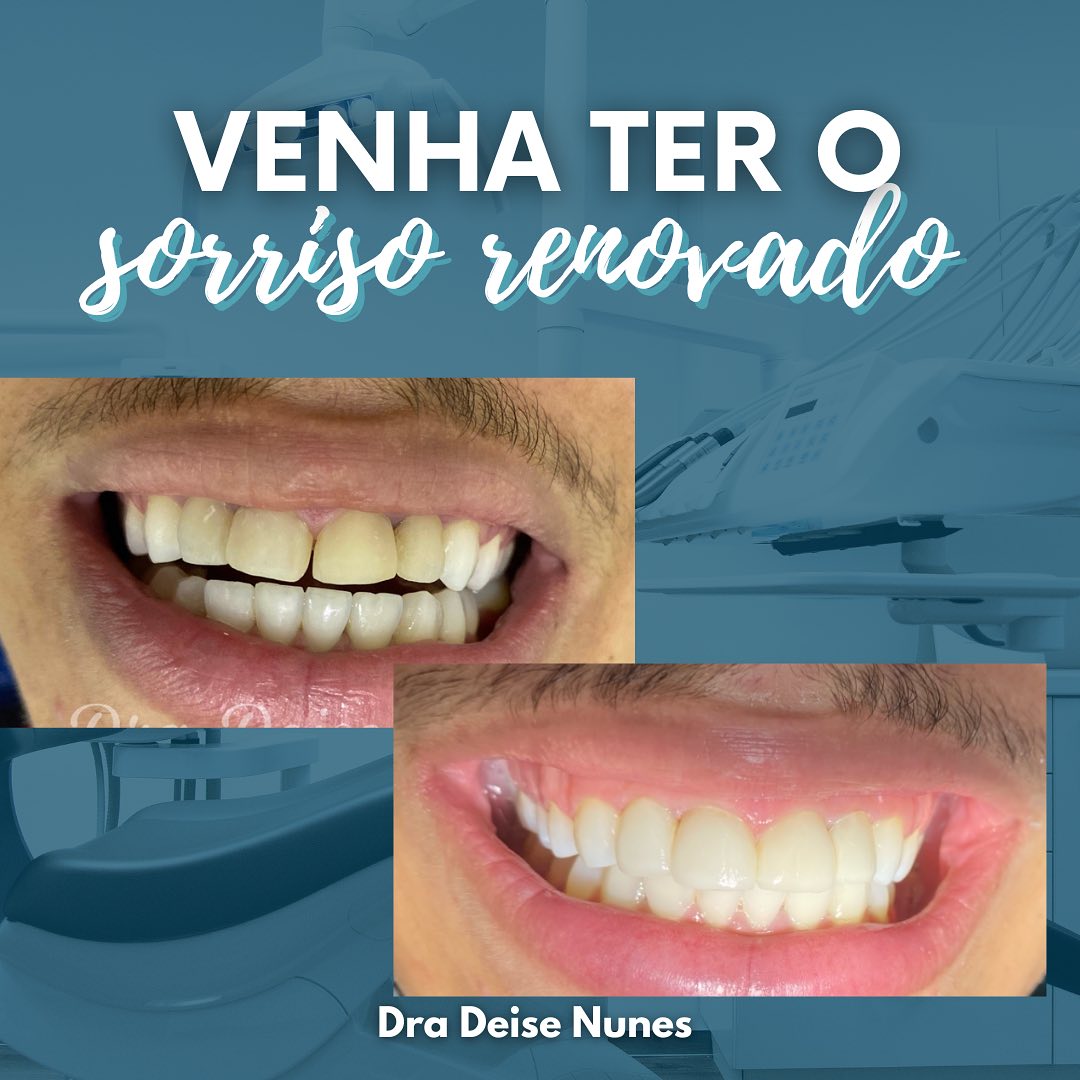 Resultado 2: Descrição do procedimento e foto antes/depois